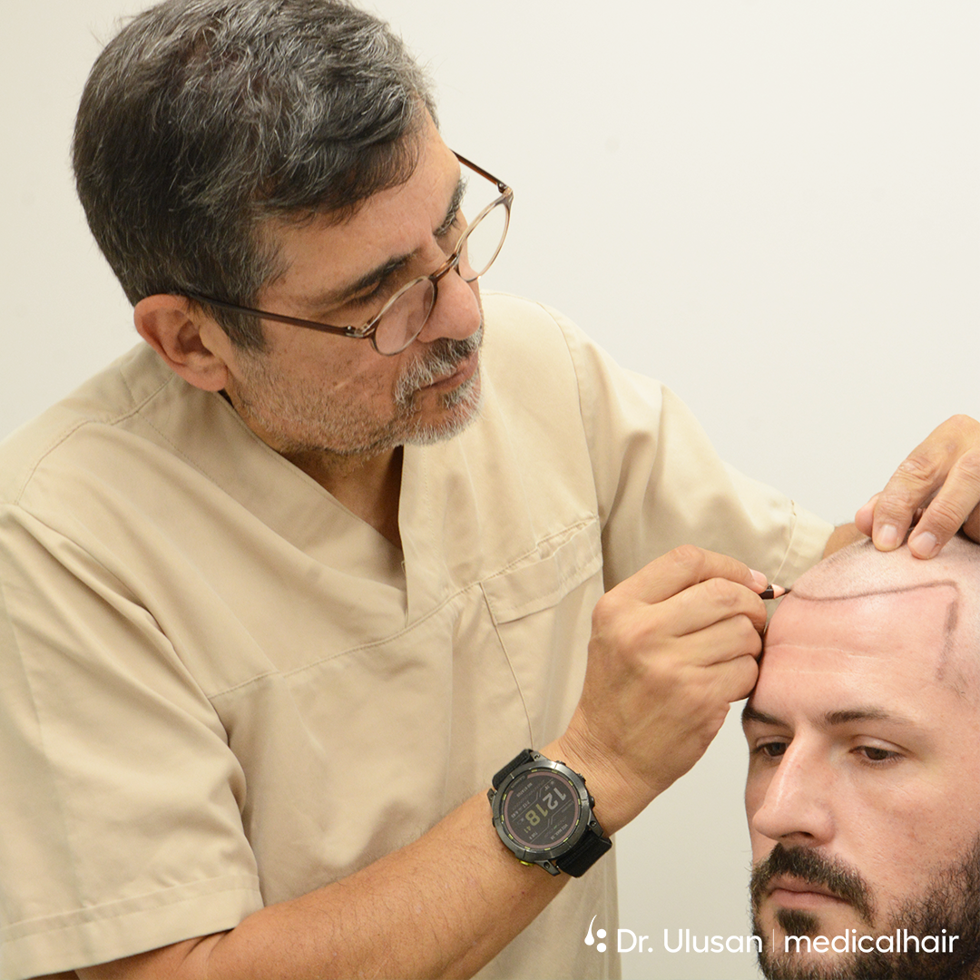 How Do Experts Design a Natural-Looking Hairline?