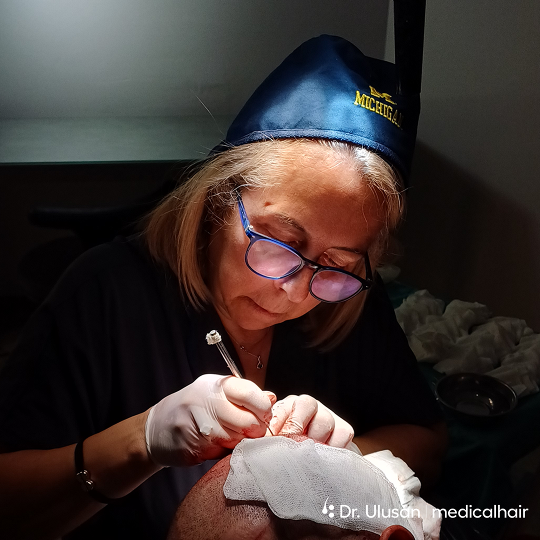 How to Massage Your Scalp After Hair Transplant