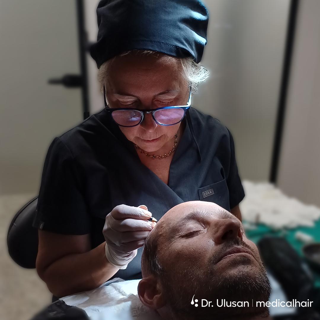 How to Sleep After a Hair Transplant and Why It Matters