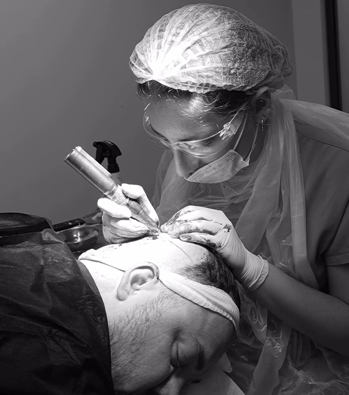 How to Prepare for the Hair Transplant Operation