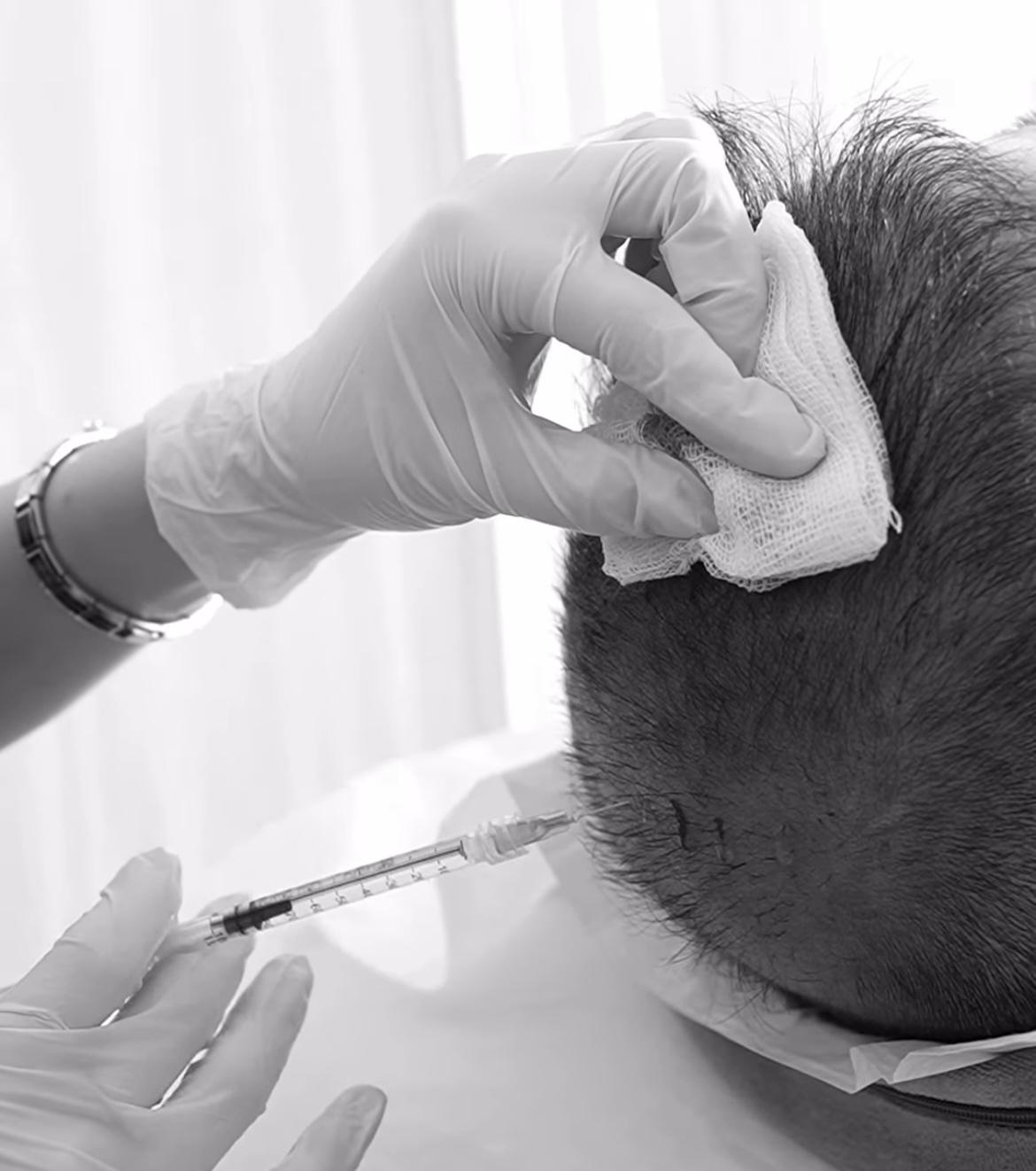 Finasterid’in Psikolojik Belirtileri