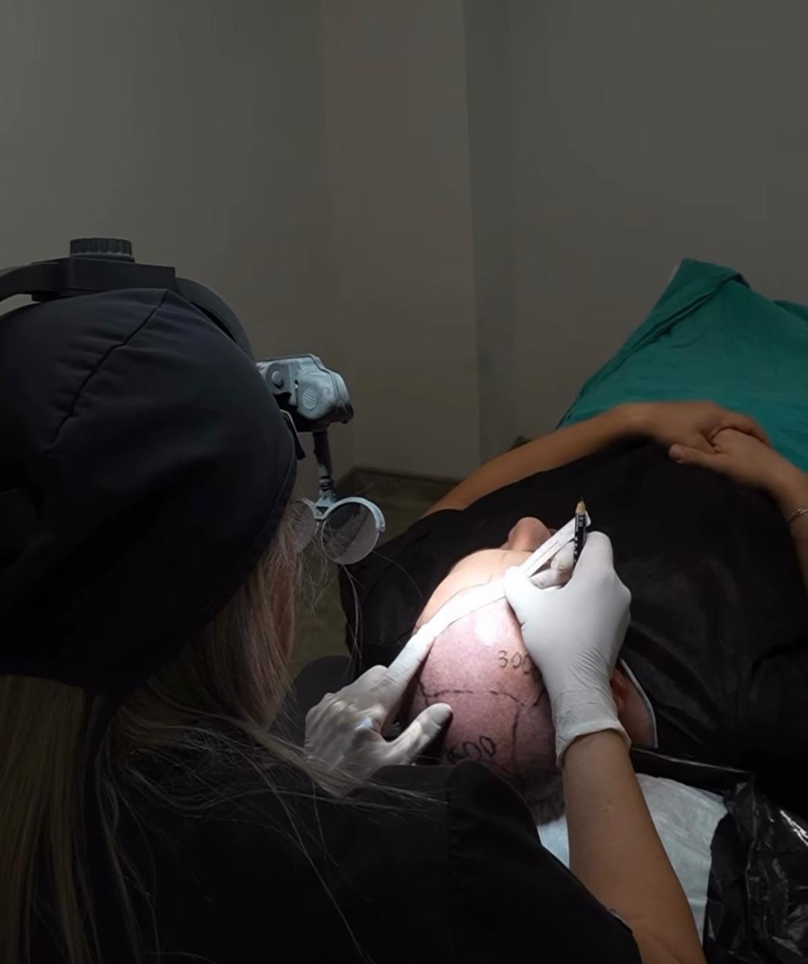 FUE Sonrası İyileşme: İlk 30 Günde Neler Beklenmeli?