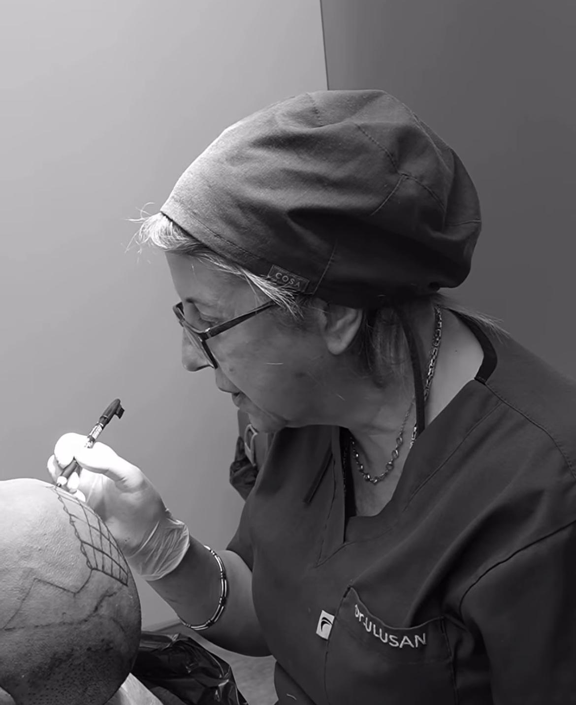 FUE Saç Büyüme Zaman Çizelgesi: Aylık Beklentiler