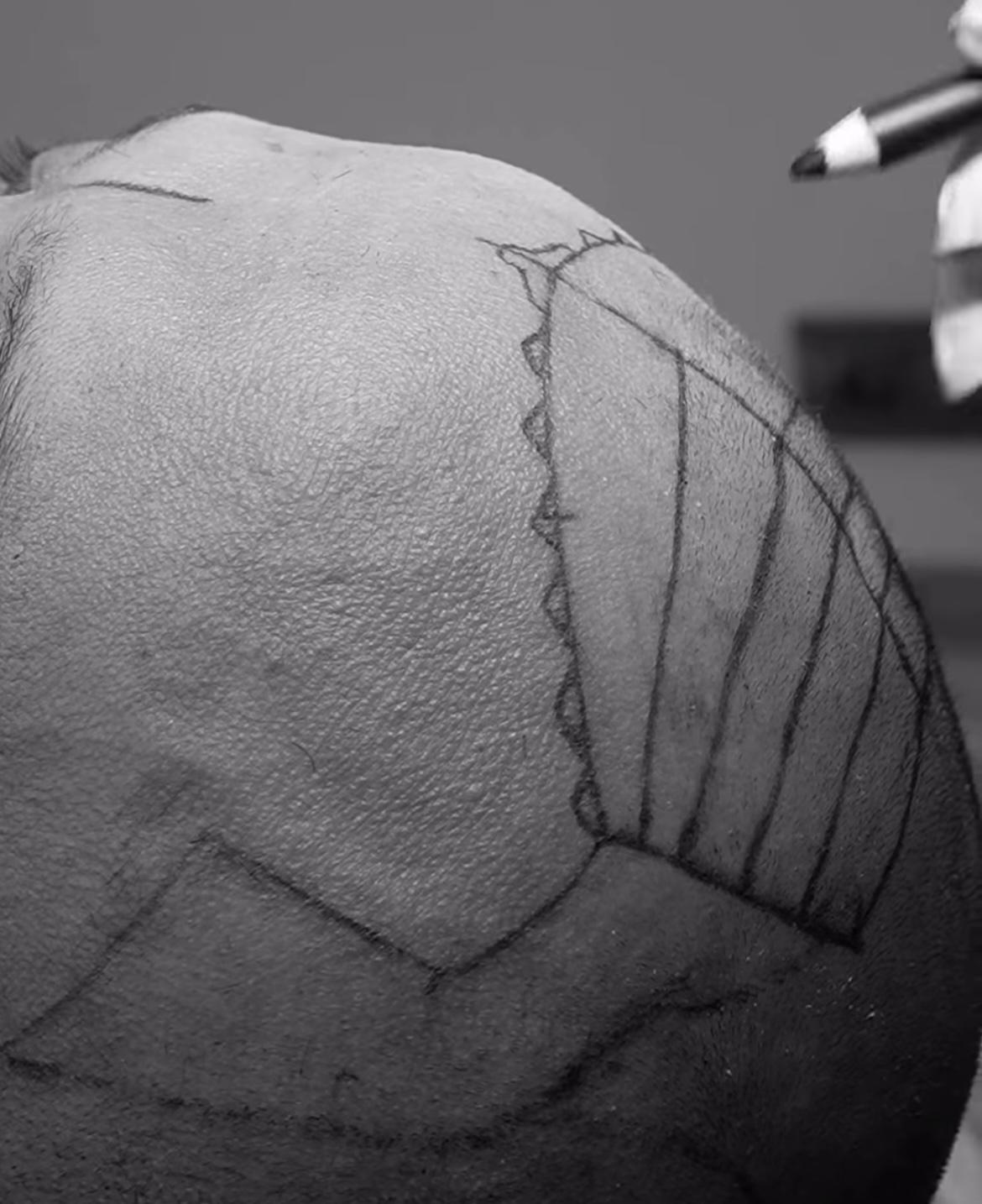 How Smoking Affect Hair Loss and Thinning